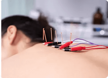 Sport Physiotherapy Treatment Medical Acupuncture