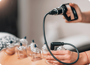 Low Back & Hip Pain in Ottawa 12 Cupping Technique