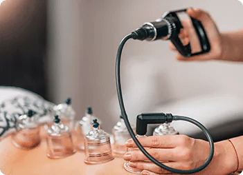 Sport Physiotherapy Treatment Cupping