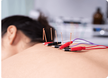 Low Back & Hip Pain in Ottawa 7 Medical Acupuncture in Ottawa